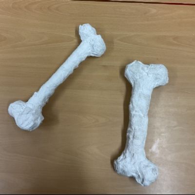 Bones